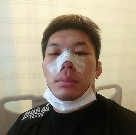 Rizin 斎藤裕が折れた鼻を手術 全治2カ月 相手のフックは強烈でした ゴング格闘技