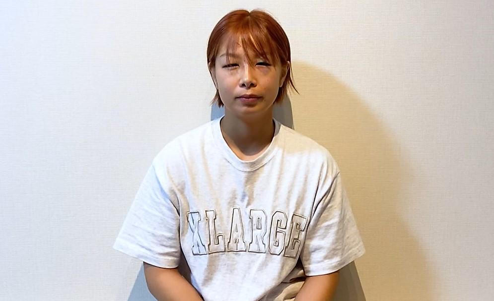 【RIZIN】浅倉カンナ、パク・シウ戦のダメージで『あれ？ さっきシャワー浴びたんだっけ？』紫色に変色した太ももも公開、今後は「ゆっくり休みます」